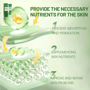Aichun Beauty Acne Clean Spot Care X | كريم علاج حب الشباب