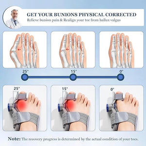 FeetifFix – Bunion Toe Corrector | مصحح تشوه الإبهام